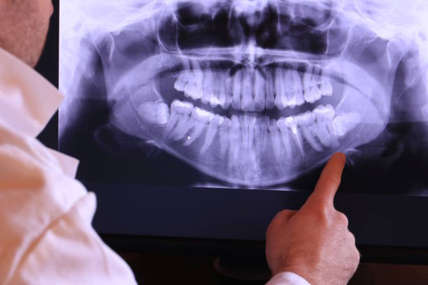 Best Emergency Dental Extractions in Knightstown, IN